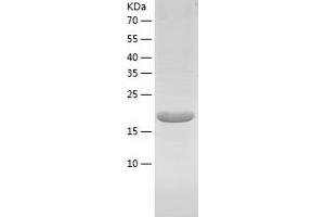 Western Blotting (WB) image for Calcium Modulating Ligand (CAMLG) (AA 1-189) protein (His tag) (ABIN7286264) (CAMLG Protein (AA 1-189) (His tag))