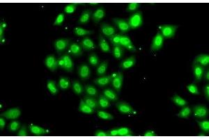 Immunofluorescence analysis of U2OS cells using PIAS3 Polyclonal Antibody (PIAS3 antibody)