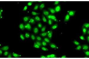 Immunofluorescence analysis of U2OS cells using PIAS3 Polyclonal Antibody (PIAS3 antibody)