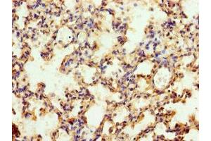 Immunohistochemistry of paraffin-embedded human lung tissue using ABIN7174683 at dilution of 1:100 (MFSD11 antibody  (AA 191-238))