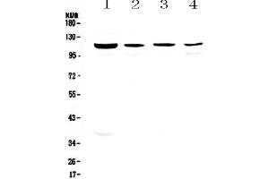 Western blot analysis of RPGR using anti-RPGR antibody . (RPGR antibody  (AA 13-338))