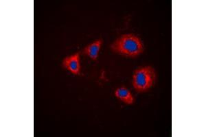 Immunofluorescent analysis of Aurora A (pT288) staining in HEK293T cells. (Aurora A antibody  (pSer288))