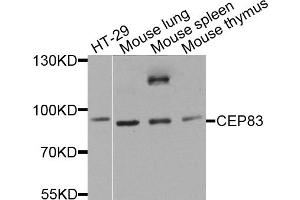 Western blot analysis of extracts of various cell lines, using CEP83 antibody. (CCDC41 antibody)