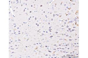 IHC analysis of PLD3 using anti-PLD3 antibody (ABIN7599439). (PLD3 antibody  (AA 1-490))