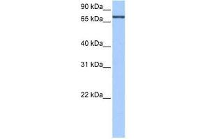 Human Liver; WB Suggested Anti-AGXT2L2 Antibody Titration: 0.