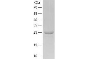 Western Blotting (WB) image for Nicotinamide Nucleotide Adenylyltransferase 3 (NMNAT3) (AA 1-252) protein (His tag) (ABIN7288456) (NMNAT3 Protein (AA 1-252) (His tag))