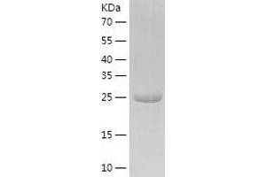NMNAT3 Protein (AA 1-252) (His tag)