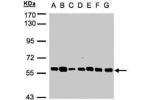 WB Image Sample(30 ug whole cell lysate) A: 293T B: A431 , C: H1299 D: HeLa S3 , E: Hep G2 , F: MOLT4 , G: Raji , 7. (TULP1 antibody)