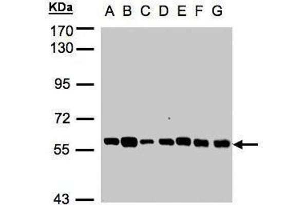 TULP1 antibody