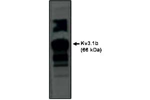 Western Blotting (WB) image for anti-Potassium Voltage-Gated Channel, Shaw-Related Subfamily, Member 1 (KCNC1) antibody (ABIN306876)