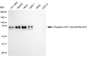 Western blotting analysis using phospho-HSF1 (Ser303/Ser307) antibody (ABIN7798864).