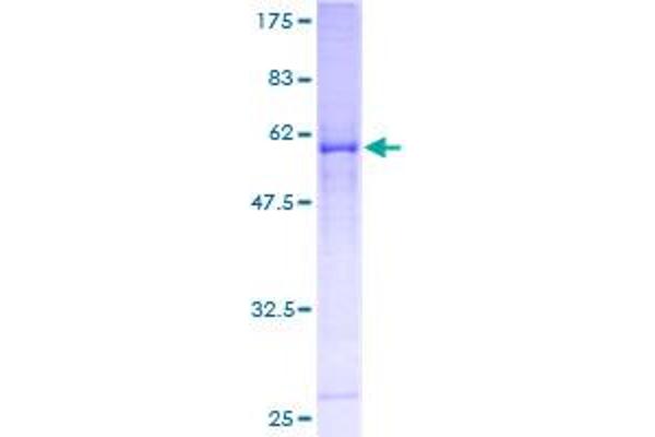 CDK4 Protein (AA 1-303) (GST tag)