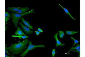 Immunofluorescence of monoclonal antibody to ITGA1 on HeLa cell. (Integrin alpha 1 antibody  (AA 951-1059))