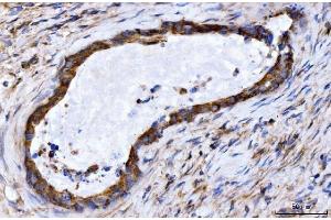 IHC analysis of GIGYF2 using anti-GIGYF2 antibody (ABIN7601679). (GIGYF2 antibody  (AA 413-1299))