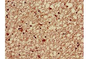 Immunohistochemistry of paraffin-embedded human brain tissue using ABIN7143166 at dilution of 1:100 (Activator of Basal Transcription 1 antibody  (AA 197-270))