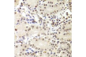 Immunohistochemistry of paraffin-embedded human stomach using PRPF3 Antibody (ABIN5973192) at dilution of 1/100 (40x lens). (PRPF3 antibody)