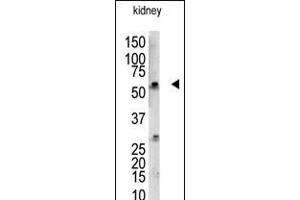 Antibody is used in Western blot to detect UBCE7IP3 in mouse kidney tissue lysate.