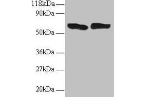 Western blot All lanes: TNF antibody at 2 μg/mL Lane 1: 293T whole cell lysate Lane 2: EC109 whole cell lysate Secondary Goat polyclonal to rabbit IgG at 1/15000 dilution Predicted band size: 26 kDa Observed band size: 60 kDa (TNF alpha antibody  (AA 78-234))