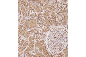 Immunohistochemical analysis of C on paraffin-embedded Human kidney tissue. (SERPINA6 antibody  (AA 197-225))