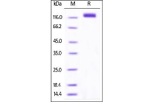 Biotinylated Human VEGF R2, His Tag on SDS-PAGE under reducing (R) condition. (VEGFR2/CD309 Protein (AA 20-764) (His tag,AVI tag,Biotin))