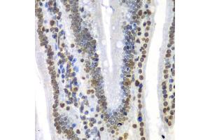 Immunohistochemistry of paraffin-embedded mouse Intestine using SEPT7 antibody (ABIN5974146) at dilution of 1/100 (40x lens).
