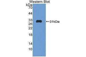 Western blot analysis of the recombinant protein. (Follistatin antibody  (AA 35-283))