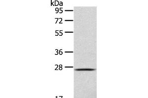 Western Blot analysis of 293T cell using CLEC4D Polyclonal Antibody at dilution of 1:123 (CLEC4D antibody)