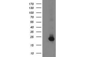 HEK293T cells were transfected with the pCMV6-ENTRY control (Left lane) or pCMV6-ENTRY GUK1 (Right lane) cDNA for 48 hrs and lysed. (GUK1 antibody)