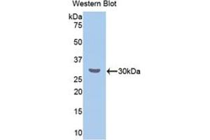 Western blot analysis of the recombinant protein. (CETP antibody  (AA 232-487))