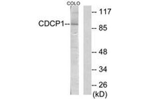 Western blot analysis of extracts from COLO205 cells, using CDCP1 Antibody. (CDCP1 antibody  (AA 691-740))