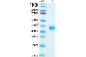 SARS-COV-2 Spike RBD on Tris-Bis PAGE under reduced condition. (SARS-CoV-2 Spike Protein (RBD) (His-Avi Tag))