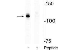 Western blot of HeLa lysate showing specific immunolabeling of the ~110 kDa AR protein phosphorylated at Ser94 in the first lane (-). (Androgen Receptor antibody  (pSer94))
