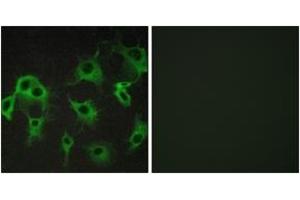 Immunofluorescence analysis of COS7 cells, using ADRB2 Antibody. (beta 2 Adrenergic Receptor antibody  (AA 336-385))