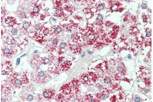 SLC7A2 antibody  (Internal Region)