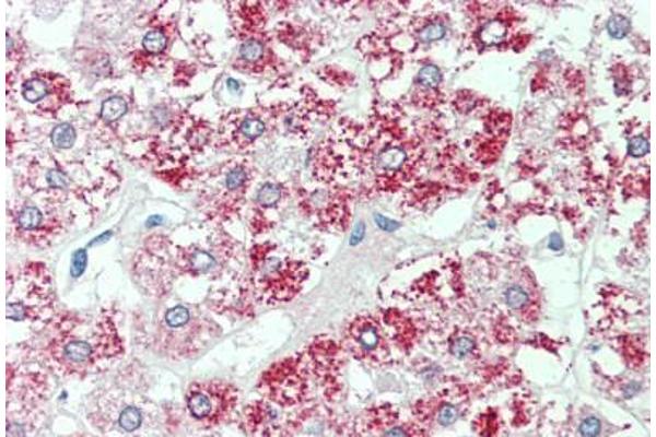 SLC7A2 antibody  (Internal Region)