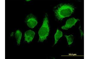 Immunofluorescence of purified MaxPab antibody to MDS028 on HeLa cell. (ITFG2 antibody  (AA 1-447))