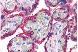 Human Placenta (formalin-fixed, paraffin-embedded) stained with TGM2 antibody ABIN307194 at 5 ug/ml followed by biotinylated goat anti-rabbit IgG secondary antibody ABIN481713, alkaline phosphatase-streptavidin and chromogen. (Transglutaminase 2 antibody)