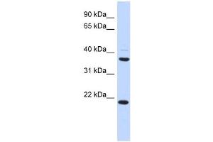 TMEM74 antibody used at 1 ug/ml to detect target protein. (TMEM74 antibody  (Middle Region))