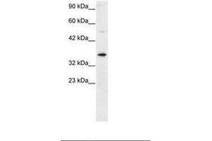 Image no. 2 for anti-General Transcription Factor IIH, Polypeptide 3, 34kD (GTF2H3) (AA 59-108) antibody (ABIN6735772)
