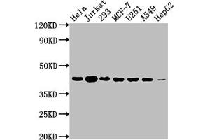 Western Blot Positive WB detected in: Hela whole cell lysate, Jurkat whole cell lysate, 293 whole cell lysate, MCF-7 whole cell lysate, U251 whole cell lysate, A549 whole cell lysate, HepG2 whole cell lysate All lanes: AURKB antibody at 1:2000 Secondary Goat polyclonal to rabbit IgG at 1/50000 dilution Predicted band size: 40, 36, 17, 35 kDa Observed band size: 40 kDa (Recombinant Aurora Kinase B antibody)