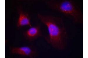 Immunofluorescence staining of methanol-fixed Hela cells using syk(phospho-Tyr323) Antibody. (SYK antibody  (pTyr323))