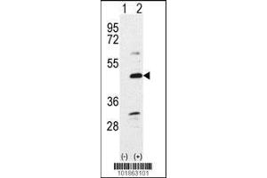 Western blot analysis of Bmp7 using rabbit polyclonal Bmp7 Antibody using 293 cell lysates (2 ug/lane) either nontransfected (Lane 1) or transiently transfected with the Bmp7 gene (Lane 2).