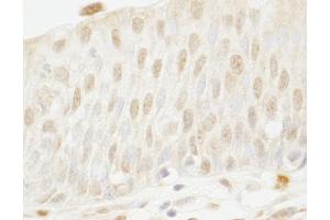 Immunohistochemistry (IHC) image for anti-Myb-Binding Protein 1A (MYBBP1A) (AA 450-500) antibody (ABIN7448678) (MYBBP1A antibody  (AA 450-500))