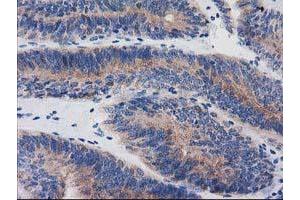 Immunohistochemistry (IHC) image for anti-Bridging Integrator 3 (BIN3) antibody (ABIN1496922) (BIN3 antibody)