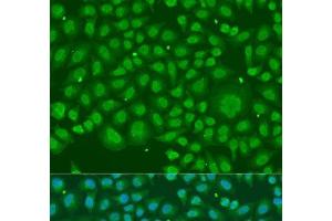 Immunofluorescence analysis of U2OS cells using HNRNPR Polyclonal Antibody at dilution of 1:100. (HNRNPR antibody)