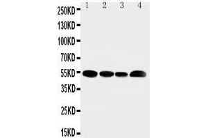 Anti-SLC16A4 antibody, Western blotting Lane 1: Rat Testis Tissue Lysate Lane 2: JURKAT Cell Lysate Lane 3: HELA Cell Lysate Lane 4: MCF-7 Cell Lysate (SLC16A4 antibody  (N-Term))
