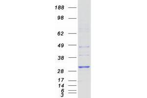 Validation with Western Blot (HLA-DRB4 Protein (Myc-DYKDDDDK Tag))