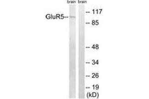 Western blot analysis of extracts from mouse brain cells, using GluR5 Antibody.