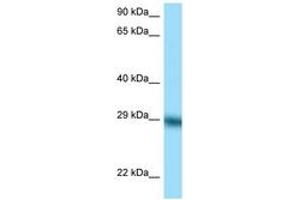 Image no. 1 for anti-Tissue Factor Pathway Inhibitor (Lipoprotein-Associated Coagulation Inhibitor) (TFPI) (C-Term) antibody (ABIN6748178) (TFPI antibody  (C-Term))