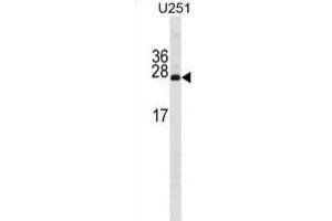 Western Blotting (WB) image for anti-PDGFA Associated Protein 1 (PDAP1) antibody (ABIN3001128)
